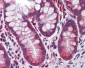 CASP8 / Caspase 8 Antibody